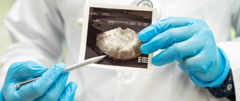 Preparation Before Myoma Surgery