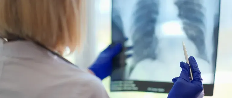 Akciğer Nodülleri nedir?