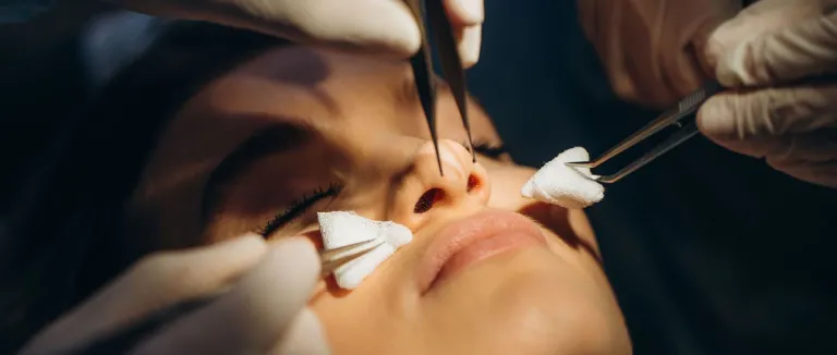 How to prepare for rhinoplasty