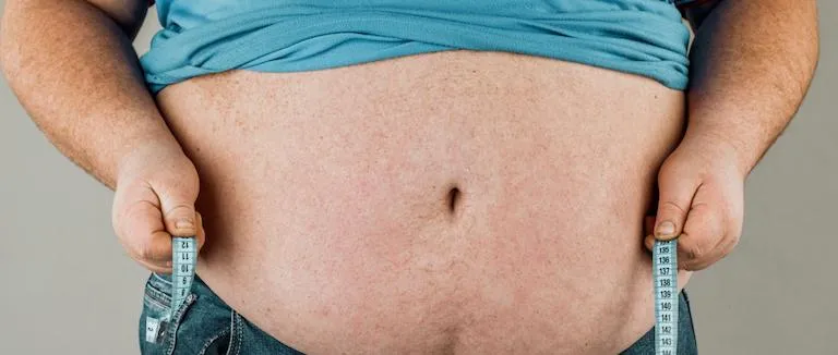 Obezite Cerrahisi nedir?