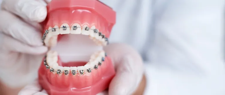 What Does Orthodontics Mean