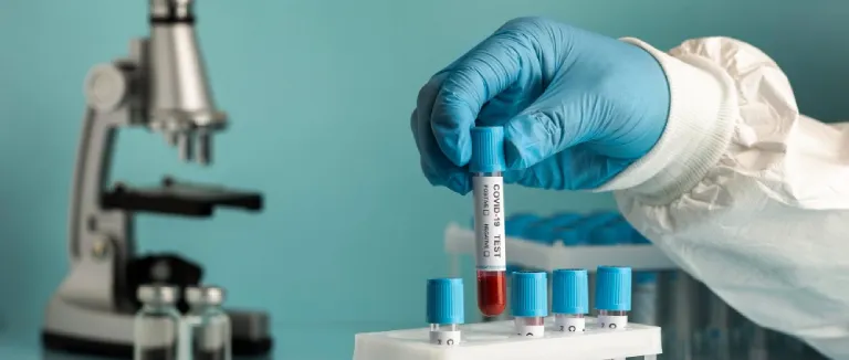 What is Oxidative Stress