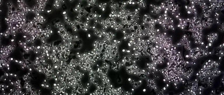 Pamukçuğa Ne İyi Gelir?