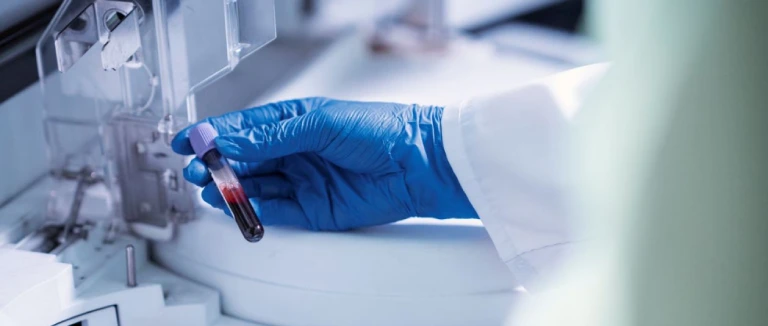 PLT Yüksekliği belirtileri