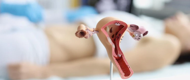 Plikistik Over Sendromu nedenleri?