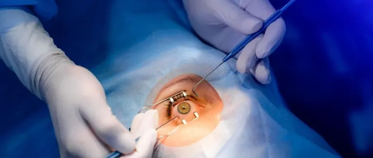 Retina Surgery (Vitrectomy), What Is It?