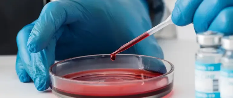 sedimantasyon-yuksekligi