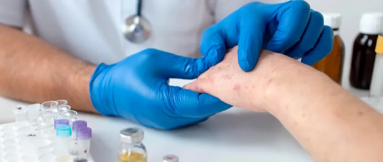 Liv Hospital For Skin Cancer Treatments