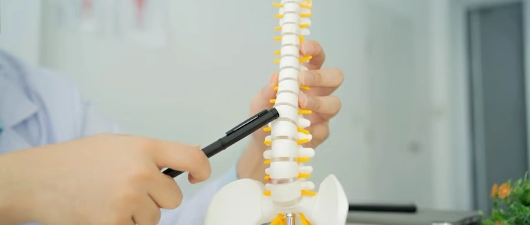 Skolyoz (Omurga Eğriliği) Nedir, Tedavisi ve Belirtileri Nelerdir?