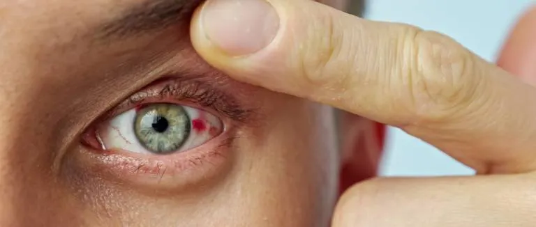 Sürekli Sol Göz Seğirmesi Neden Olur?