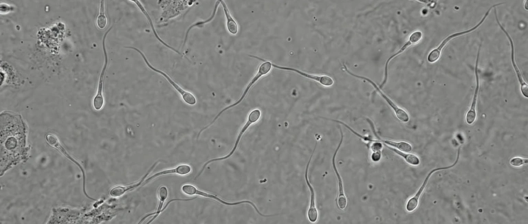 sperm-bosaltilmazsa-ne-olur