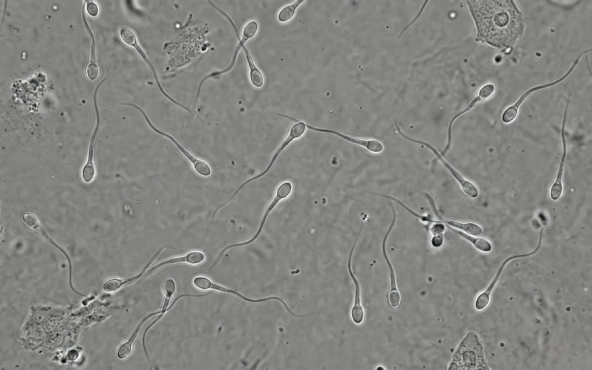 Sperm