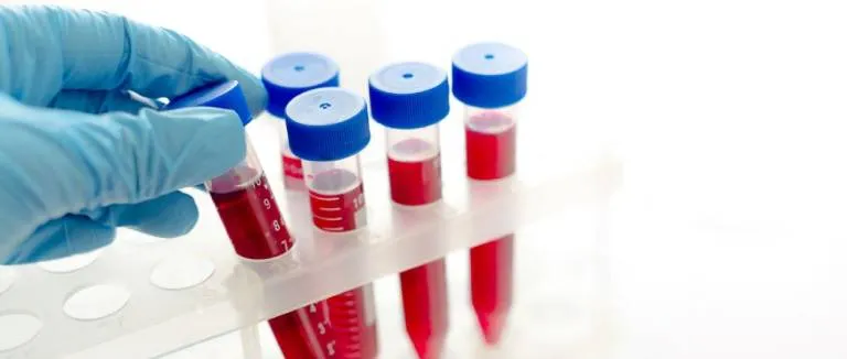 tam-kan-sayimi-nedir