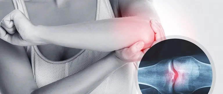 tenisci-dirsegi-tedavisi