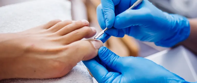 Tırnak Batması Nedenleri