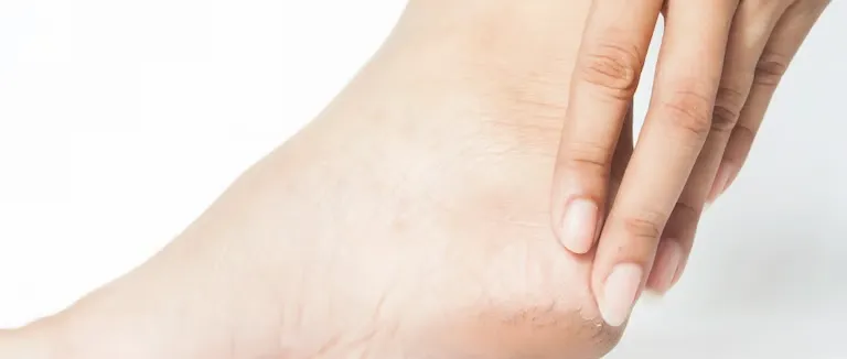 Topuk Dikeni Tedavisi