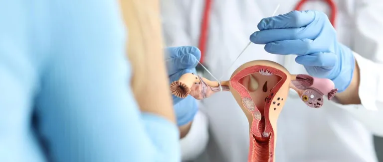 Что такое перевязка труб (трубная лигатура)?