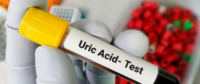 Ürik Asit Yüksekliği Nasıl Düşürülür?