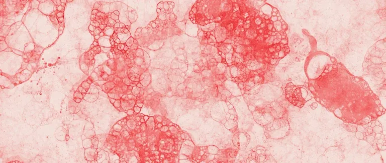 wbc-yuksekligi-nedir