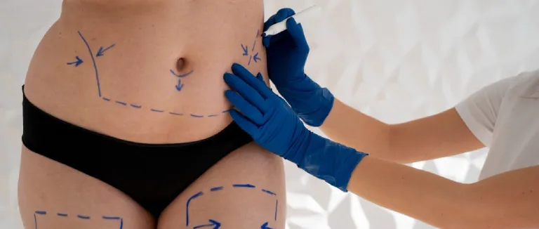 Types Of Weight Loss Surgery in Istanbul