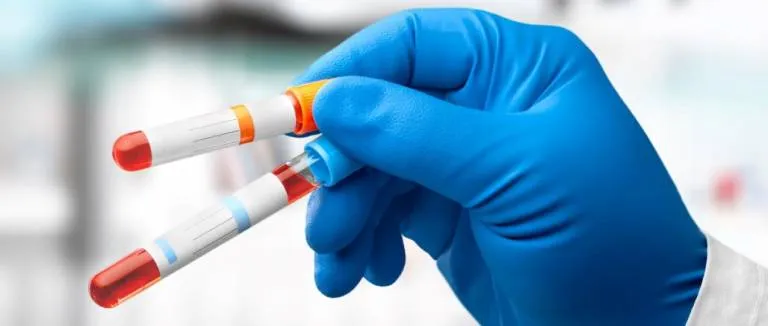 Signs and Symptoms of Atherosclerosis