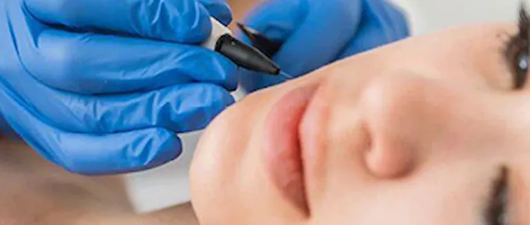 yag-bezesi-ameliyati